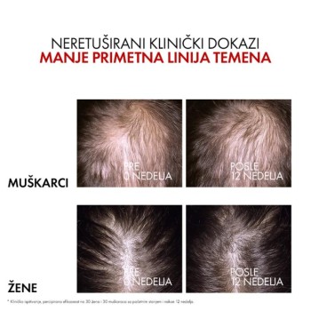 Vichy Dercos Aminexil R.E.G.E.N. Booster 90ml 