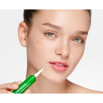 Vichy Normaderm S.O.S. sumporna pasta 20 ml