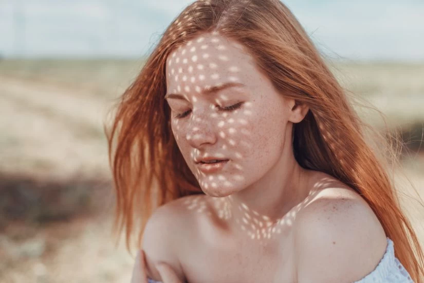 Crvenokosa devojka sa flekama od sunca na licu.